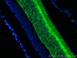 Recoverin Antibody in Immunohistochemistry (PFA fixed) (IHC (PFA))