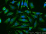 Importin Beta Antibody in Immunocytochemistry (ICC/IF)