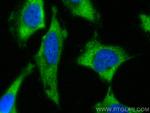 PKM Antibody in Immunocytochemistry (ICC/IF)