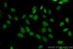 UBE2T/HSPC150 Antibody in Immunocytochemistry (ICC/IF)