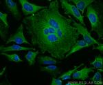 DAB2 Antibody in Immunocytochemistry (ICC/IF)