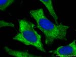 AKT Antibody in Immunocytochemistry (ICC/IF)