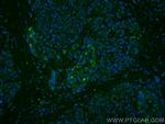 ubiquitin Antibody in Immunohistochemistry (PFA fixed) (IHC (PFA))