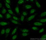 DUSP11 Antibody in Immunocytochemistry (ICC/IF)