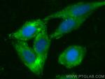 EIF2S2 Antibody in Immunocytochemistry (ICC/IF)