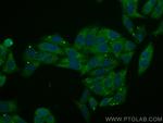 VPS35 Antibody in Immunocytochemistry (ICC/IF)