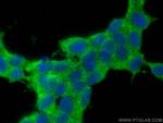 CPLX1 Antibody in Immunocytochemistry (ICC/IF)