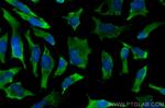 Cdc20 Antibody in Immunocytochemistry (ICC/IF)