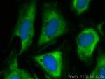 Cdc20 Antibody in Immunocytochemistry (ICC/IF)