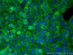 Drebrin Antibody in Immunocytochemistry (ICC/IF)