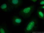 SUMO1 Antibody in Immunocytochemistry (ICC/IF)