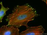 Zyxin Antibody in Immunocytochemistry (ICC/IF)