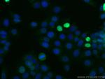 P21 Antibody in Immunocytochemistry (ICC/IF)