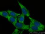 MMP2 Antibody in Immunocytochemistry (ICC/IF)