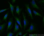 HGS Antibody in Immunocytochemistry (ICC/IF)