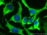 CLTB Antibody in Immunocytochemistry (ICC/IF)