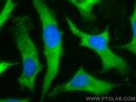 S100A14 Antibody in Immunocytochemistry (ICC/IF)