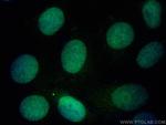 MCM2 Antibody in Immunocytochemistry (ICC/IF)