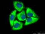 peroxiredoxin 2 Antibody in Immunocytochemistry (ICC/IF)