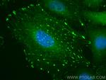 HIC5 Antibody in Immunocytochemistry (ICC/IF)
