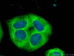 CSNK2A2 Antibody in Immunocytochemistry (ICC/IF)
