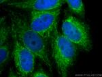 SDHB Antibody in Immunocytochemistry (ICC/IF)