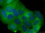 FKBP52 Antibody in Immunocytochemistry (ICC/IF)