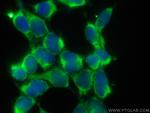 DENR Antibody in Immunocytochemistry (ICC/IF)