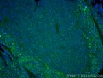 Lumican Antibody in Immunohistochemistry (PFA fixed) (IHC (PFA))