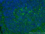 Lumican Antibody in Immunohistochemistry (PFA fixed) (IHC (PFA))
