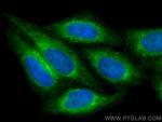 PRDX4 Antibody in Immunocytochemistry (ICC/IF)