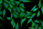 Cyclophilin A Antibody in Immunocytochemistry (ICC/IF)