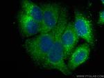 Ferritin light chain Antibody in Immunocytochemistry (ICC/IF)