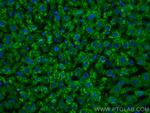 MGP Antibody in Immunohistochemistry (PFA fixed) (IHC (PFA))