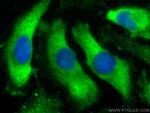 HPS3 Antibody in Immunocytochemistry (ICC/IF)