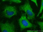 TRIP10 Antibody in Immunocytochemistry (ICC/IF)