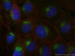 PSAP Antibody in Immunocytochemistry (ICC/IF)