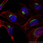 PSAP Antibody in Immunocytochemistry (ICC/IF)