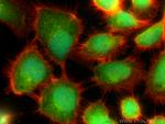 Cystatin B Antibody in Immunocytochemistry (ICC/IF)