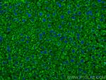 VDAC1/2 Antibody in Immunohistochemistry (PFA fixed) (IHC (PFA))