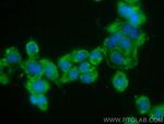 Syndecan-3 Antibody in Immunocytochemistry (ICC/IF)