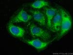 EIF3E Antibody in Immunocytochemistry (ICC/IF)