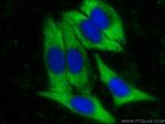 YWHAB Antibody in Immunocytochemistry (ICC/IF)
