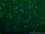 CRH/CRF Antibody in Immunohistochemistry (PFA fixed) (IHC (PFA))