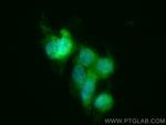 Cofilin Antibody in Immunocytochemistry (ICC/IF)