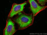 CSN2 Antibody in Immunocytochemistry (ICC/IF)