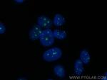 TCOF1 Antibody in Immunocytochemistry (ICC/IF)
