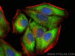 CDK5RAP3 Antibody in Immunocytochemistry (ICC/IF)