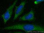 MEK1/2 Antibody in Immunocytochemistry (ICC/IF)