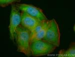 DNAJC7 Antibody in Immunocytochemistry (ICC/IF)